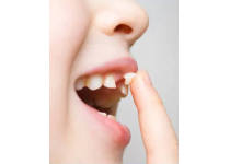孩子到了换牙期,需要注意什么?