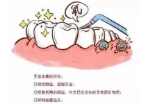为什么要做牙齿涂氟呢?