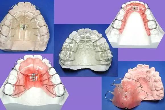 牙齿正畸.jpg 牙齿正畸.jpg