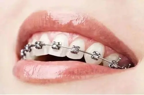 牙齿健康 牙齿健康